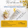 Kem trị mụn Epoch Blemish Treatment 15ml (Mẫu mới)